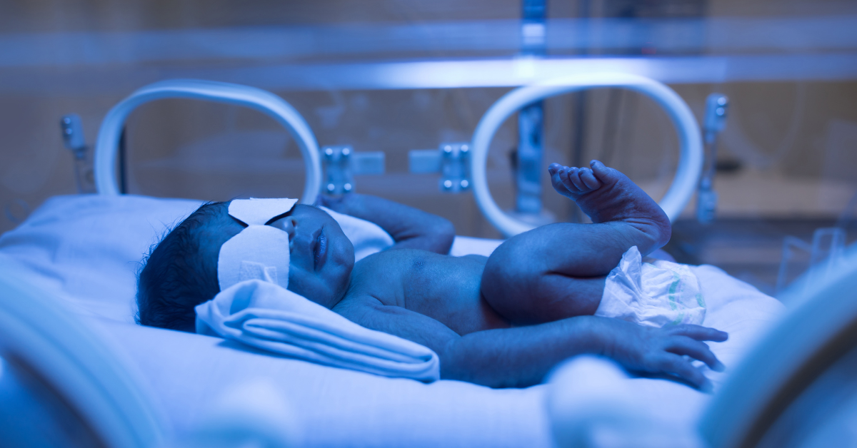 Jaundice Treatment Specialist Doctors